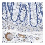 Atlas Antibodies Anti-APOL1 Antibody