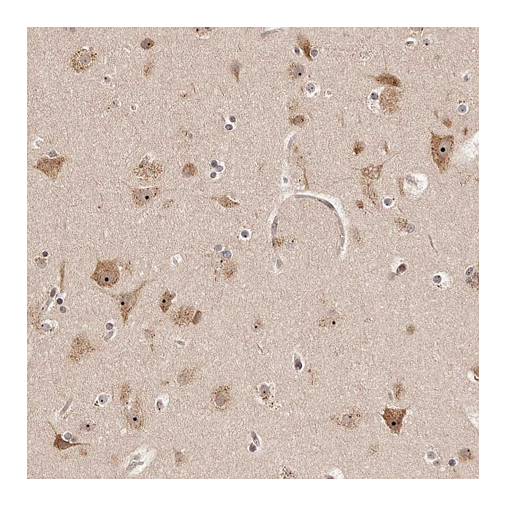 Atlas Antibodies Anti-APOL6 Antibody