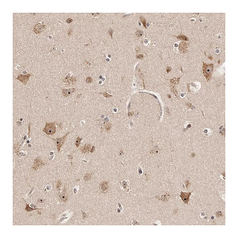 Atlas Antibodies Anti-APOL6 Antibody