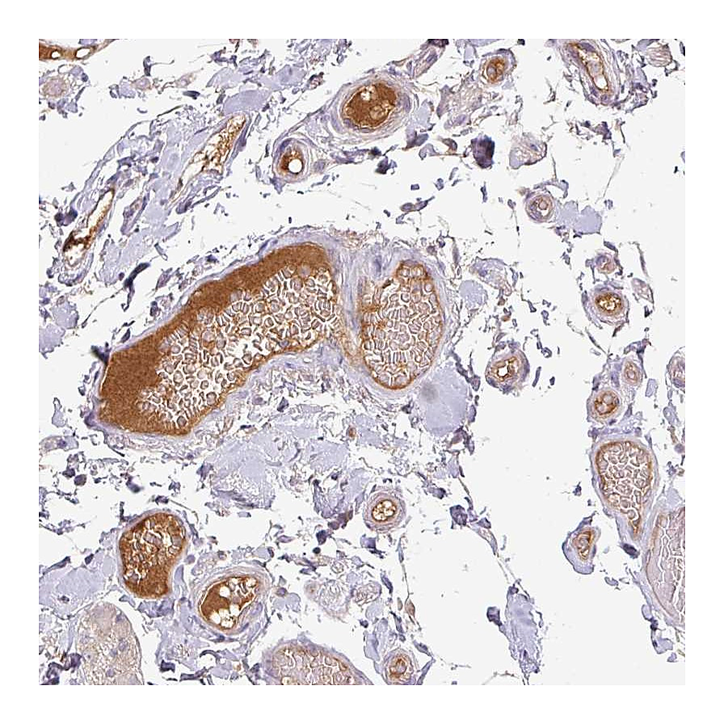 Atlas Antibodies Anti-APOM Antibody