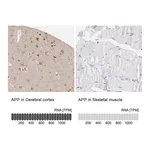 Atlas Antibodies Anti-APP Antibody