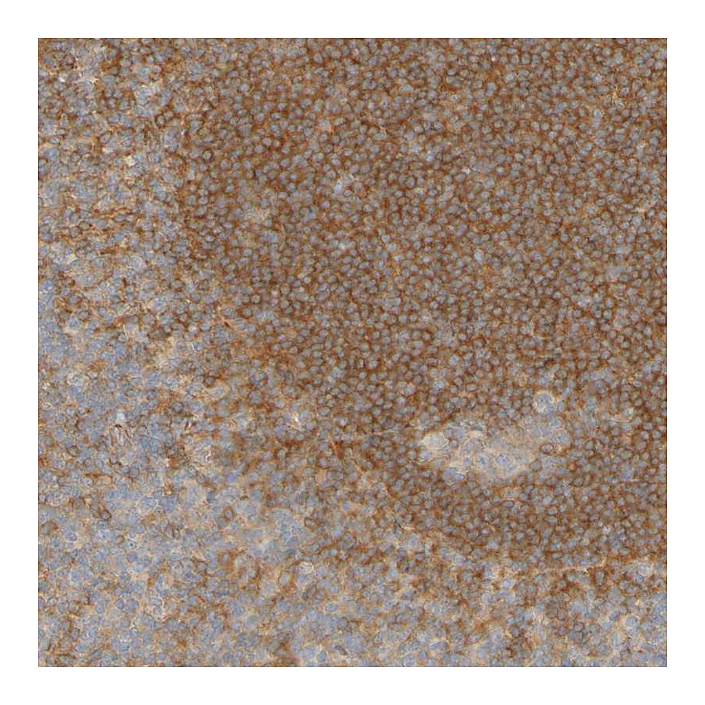 Atlas Antibodies Anti-APPL1 Antibody