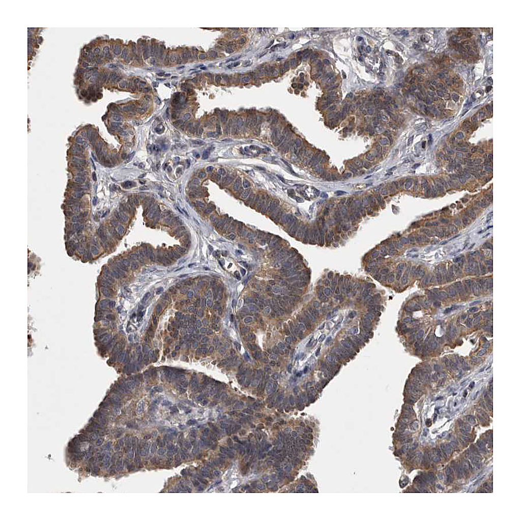 Atlas Antibodies Anti-APRT Antibody