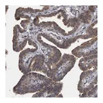 Atlas Antibodies Anti-APRT Antibody