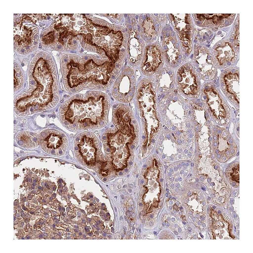 Atlas Antibodies Anti-APPL2 Antibody