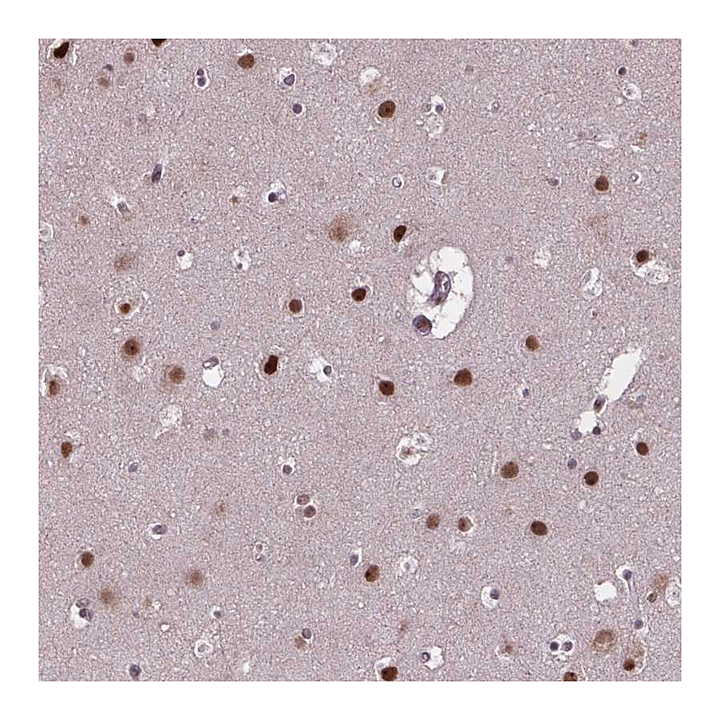Atlas Antibodies Anti-APTX Antibody