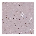 Atlas Antibodies Anti-APTX Antibody