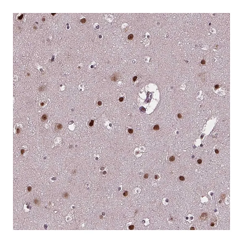 Atlas Antibodies Anti-APTX Antibody