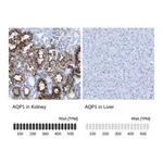 Atlas Antibodies Anti-AQP1 Antibody