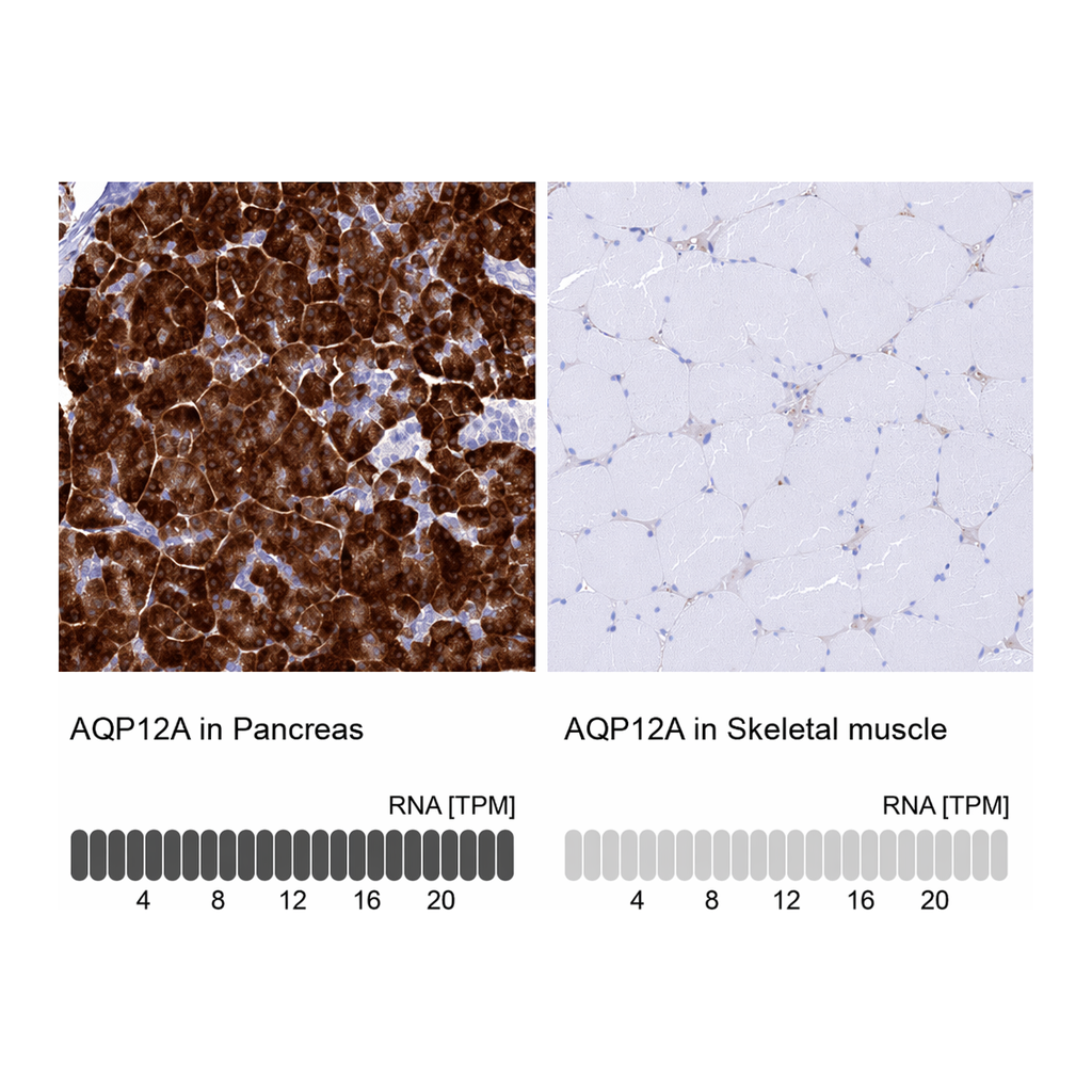 Atlas Antibodies Anti-AQP12A Antibody