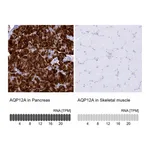 Atlas Antibodies Anti-AQP12A Antibody