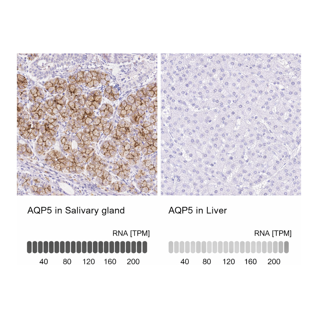 Atlas Antibodies Anti-AQP5 Antibody