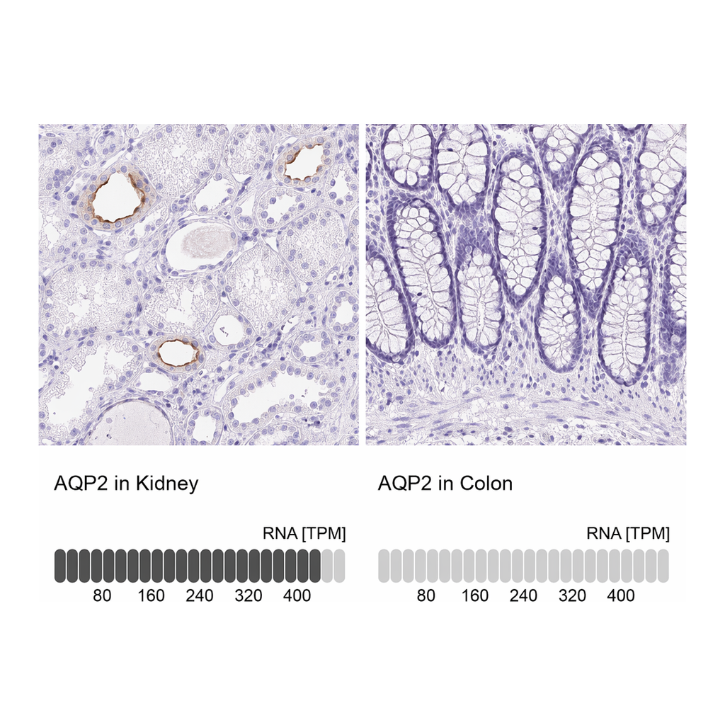 Atlas Antibodies Anti-AQP2 Antibody