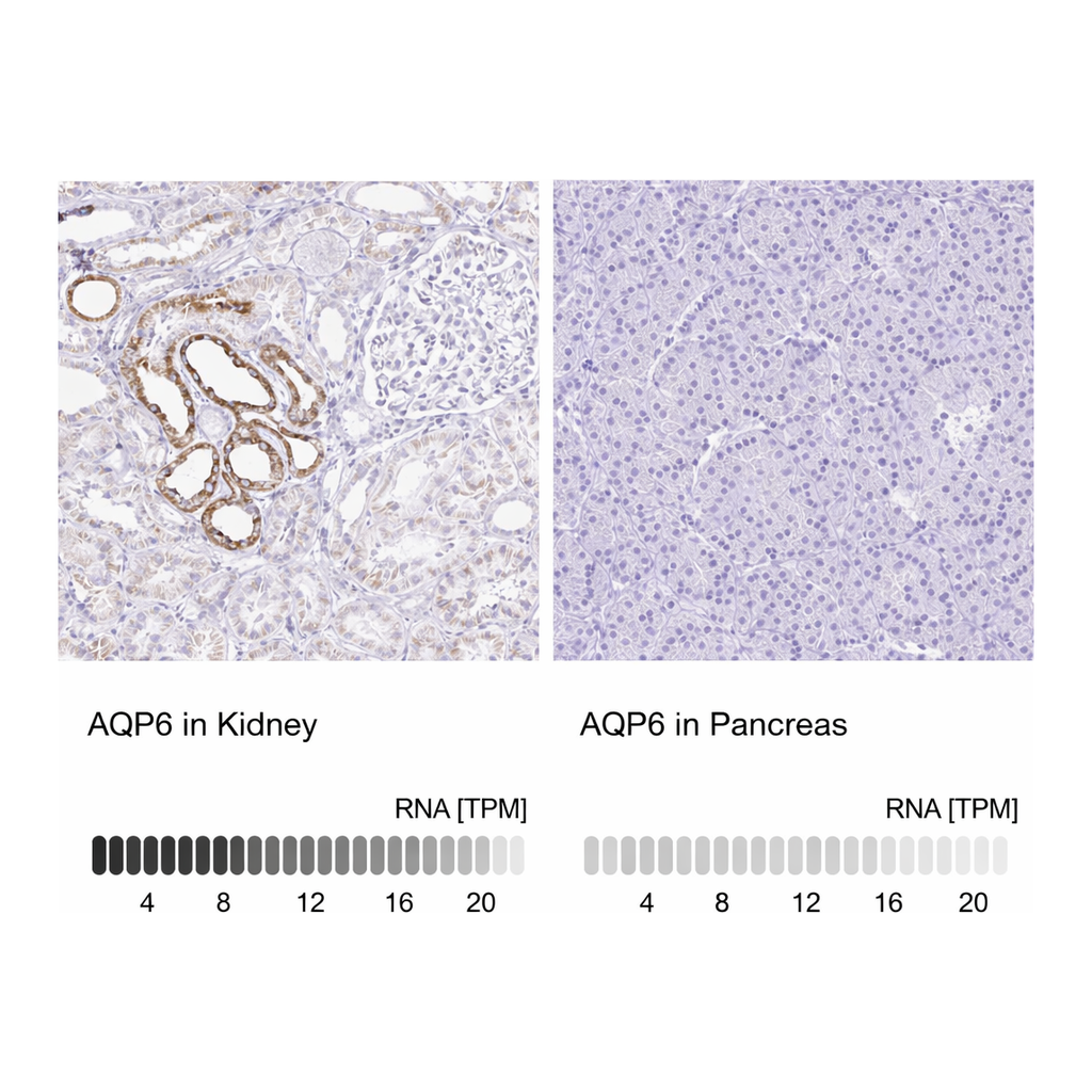 Atlas Antibodies Anti-AQP6 Antibody