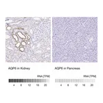 Atlas Antibodies Anti-AQP6 Antibody