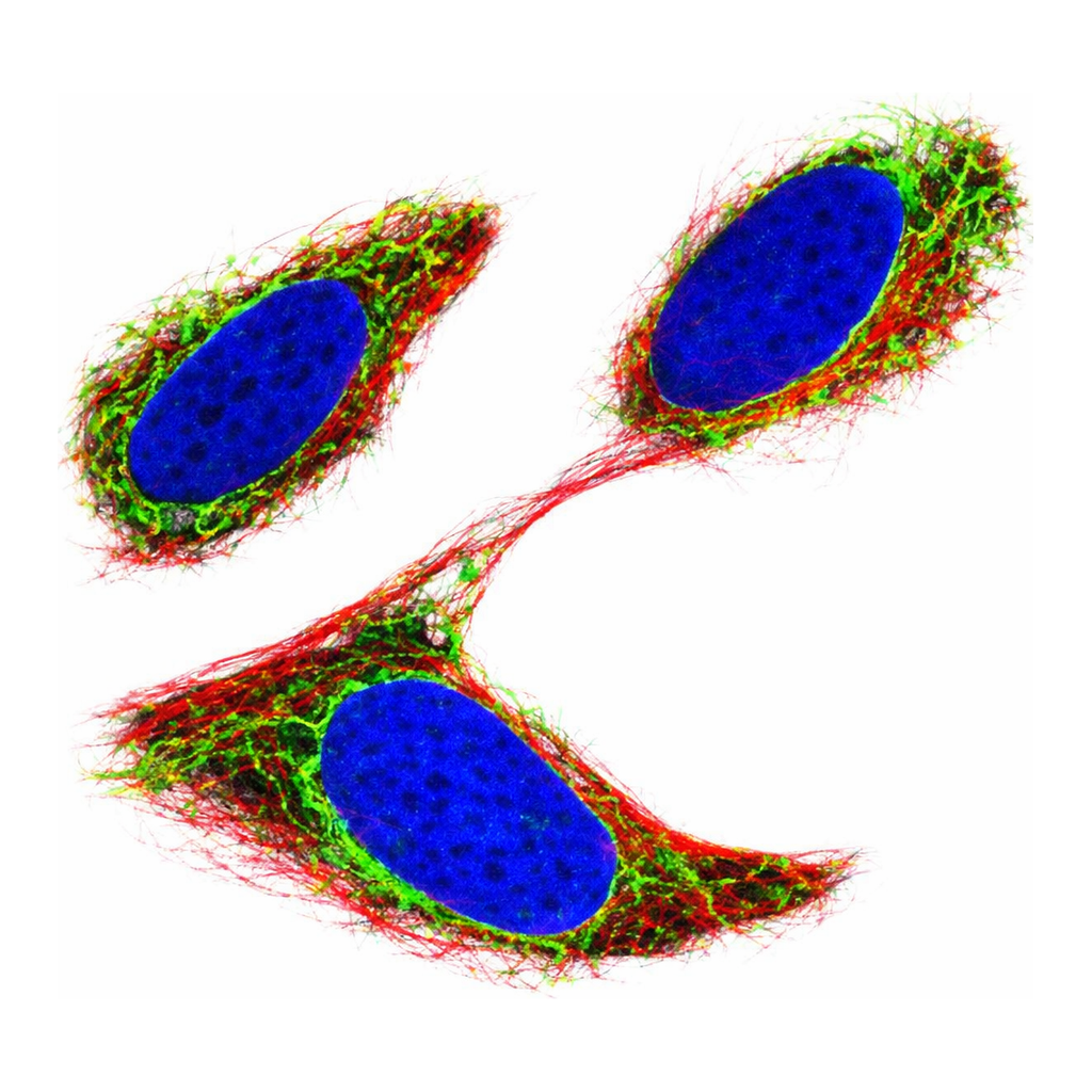 Atlas Antibodies Anti-AR Antibody