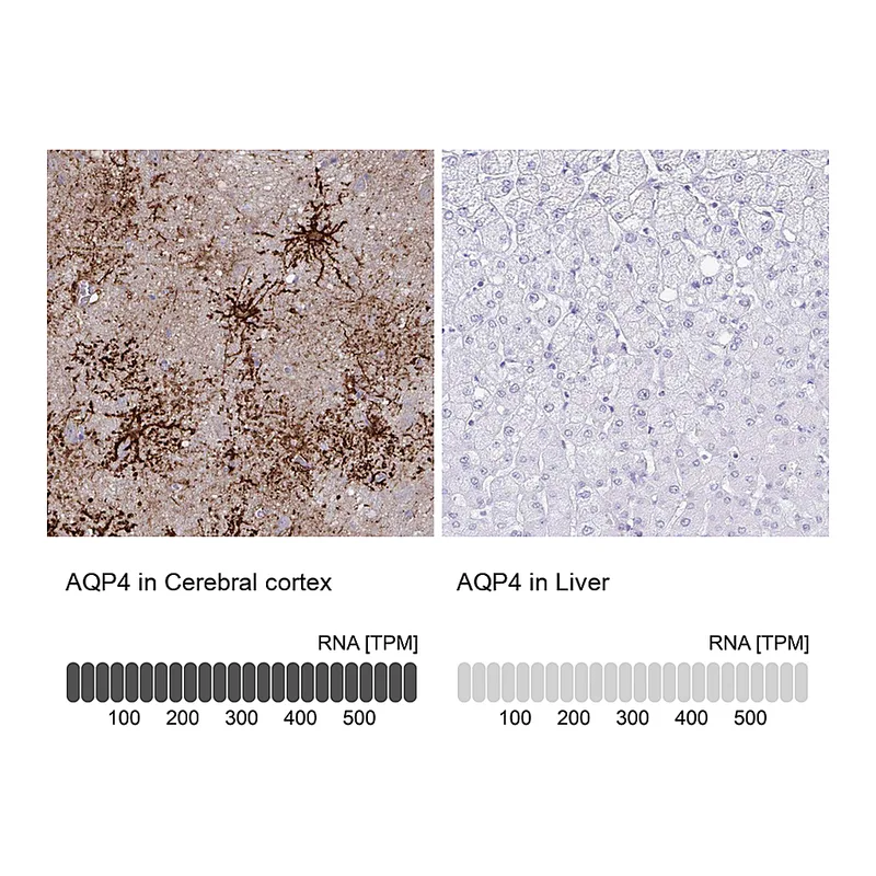 Atlas Antibodies Anti-AQP4 Antibody