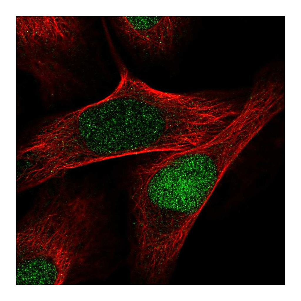 Atlas Antibodies Anti-AQR Antibody