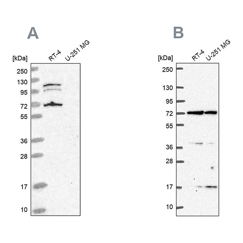 Atlas Antibodies Anti-ARAF Antibody
