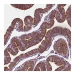Atlas Antibodies Anti-ARAF Antibody