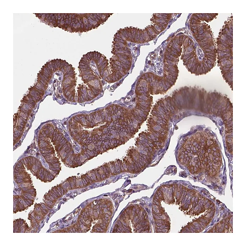 Atlas Antibodies Anti-ARAF Antibody
