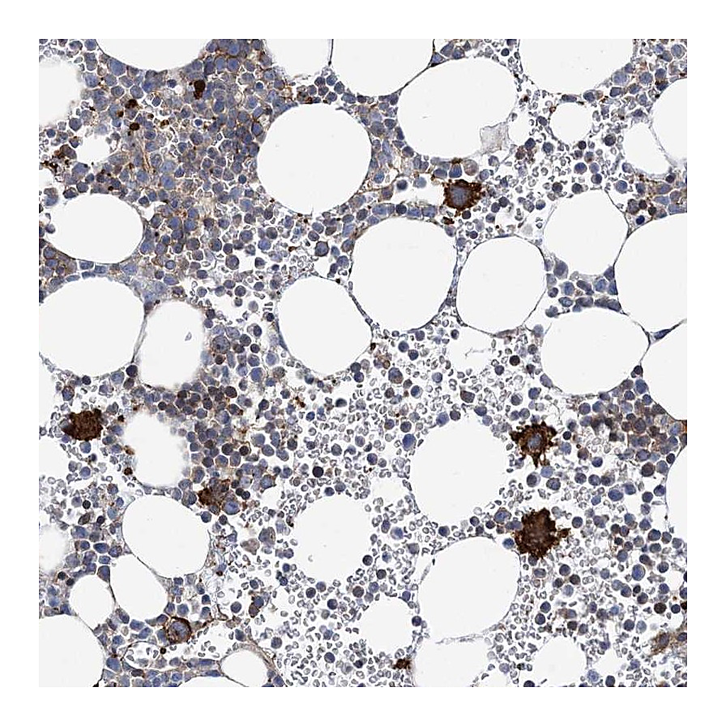 Atlas Antibodies Anti-ARAP2 Antibody