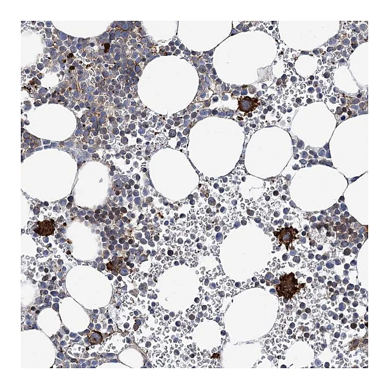 Atlas Antibodies Anti-ARAP2 Antibody