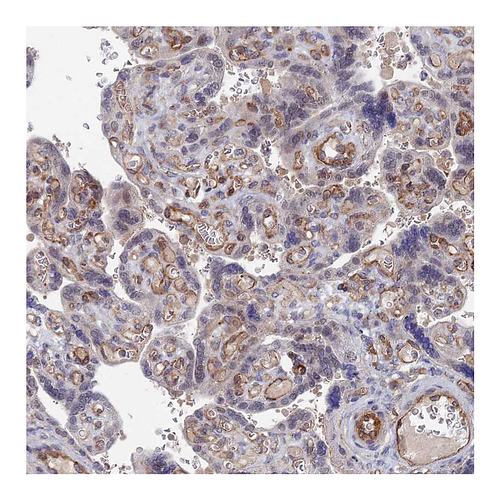 Atlas Antibodies Anti-ARAP3 Antibody