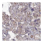 Atlas Antibodies Anti-ARAP3 Antibody