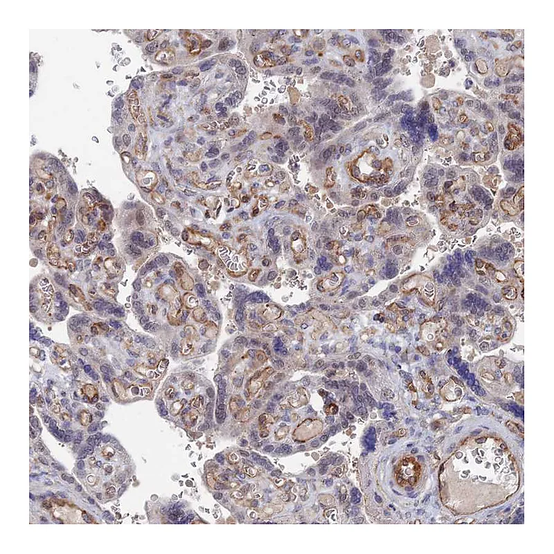 Atlas Antibodies Anti-ARAP3 Antibody