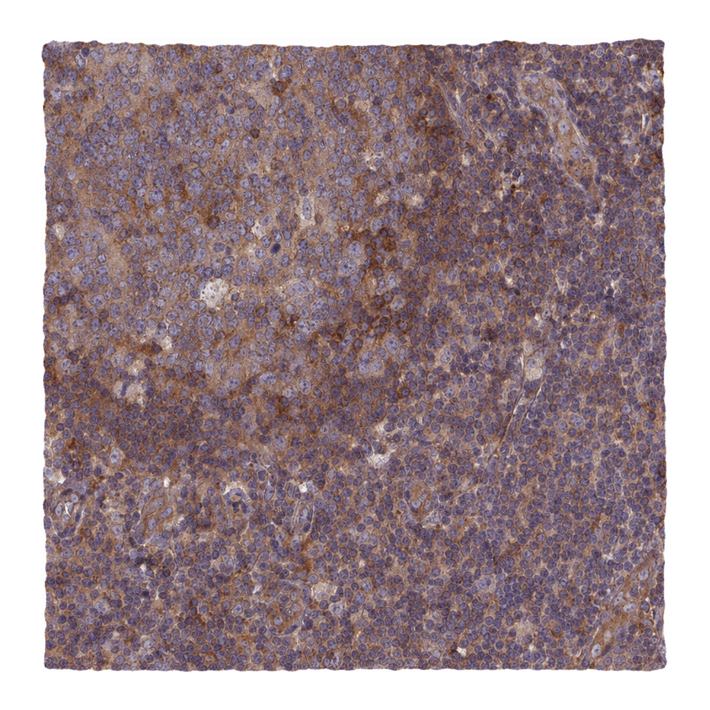Atlas Antibodies Anti-ARAP1 Antibody
