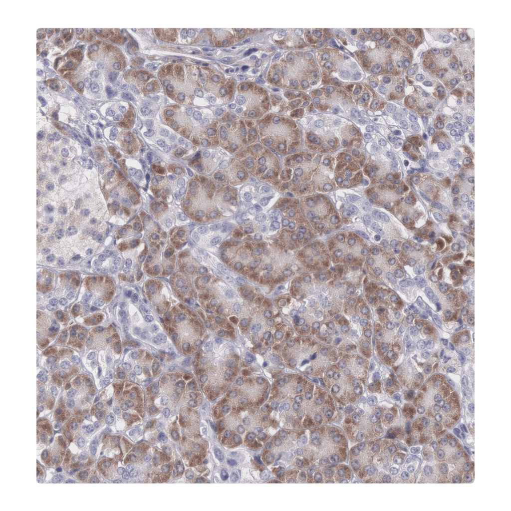 Atlas Antibodies Anti-ARFGAP3 Antibody