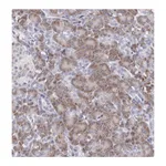 Atlas Antibodies Anti-ARFGAP3 Antibody