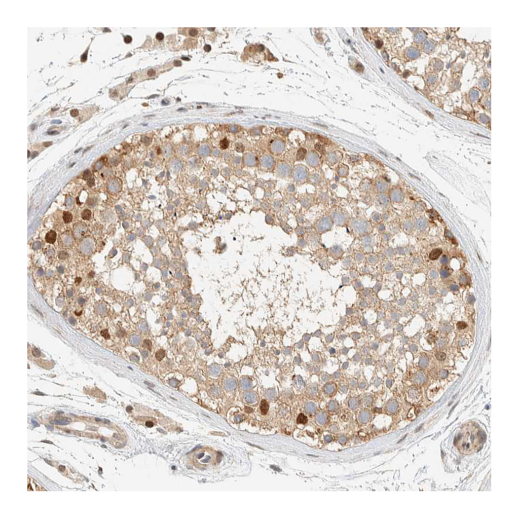 Atlas Antibodies Anti-ARFGEF1 Antibody