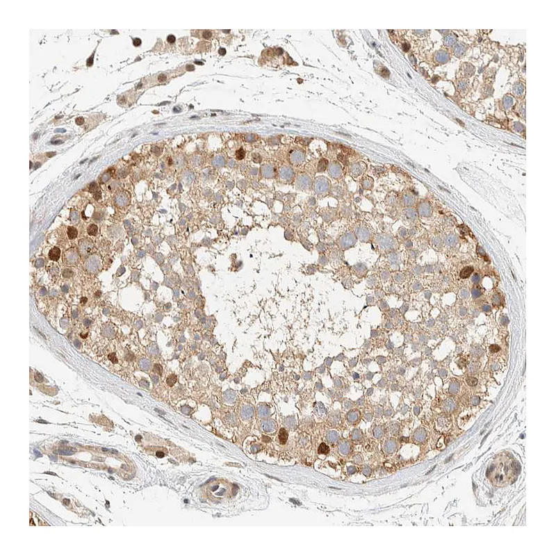 Atlas Antibodies Anti-ARFGEF1 Antibody