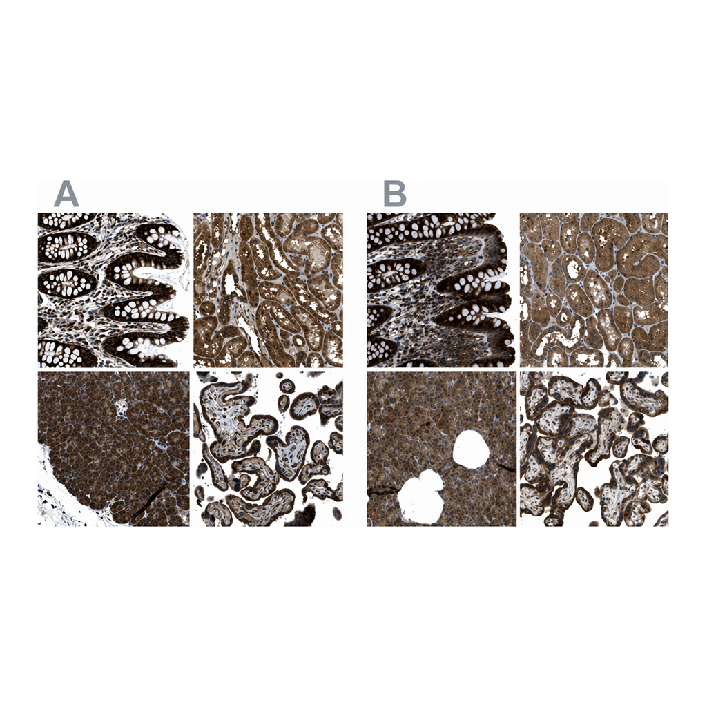 Atlas Antibodies Anti-ARFGAP2 Antibody