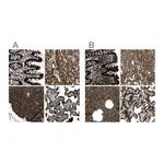 Atlas Antibodies Anti-ARFGAP2 Antibody