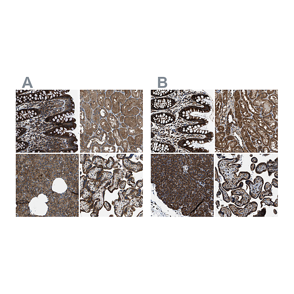 Atlas Antibodies Anti-ARFGAP2 Antibody