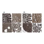 Atlas Antibodies Anti-ARFGAP2 Antibody