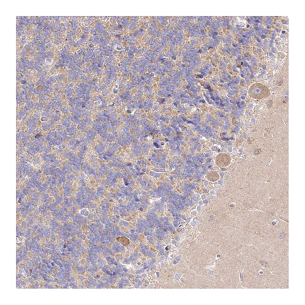 Atlas Antibodies Anti-ARFGEF3 Antibody