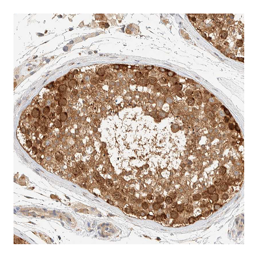 Atlas Antibodies Anti-ARFGEF1 Antibody