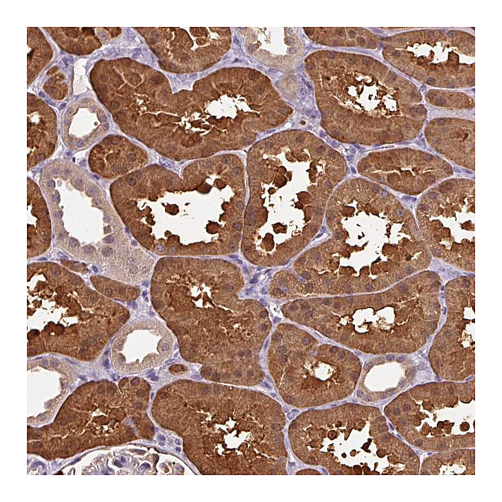 Atlas Antibodies Anti-ARFIP1 Antibody