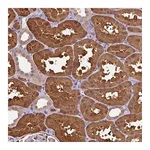 Atlas Antibodies Anti-ARFIP1 Antibody