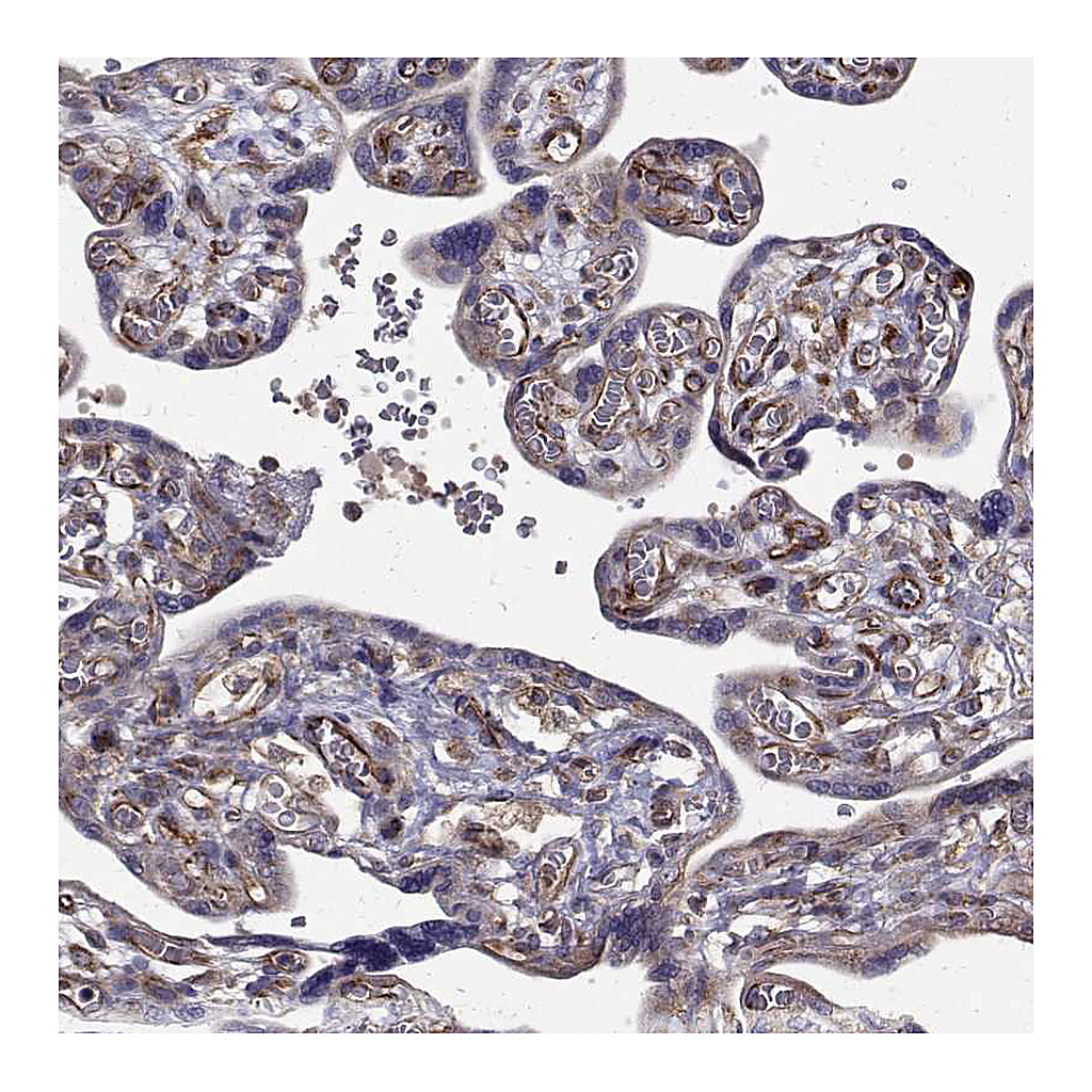 Atlas Antibodies Anti-ARFGAP1 Antibody