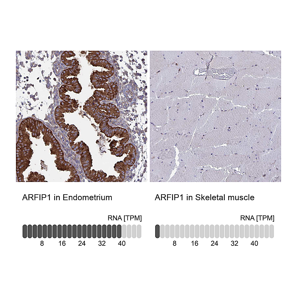 Atlas Antibodies Anti-ARFIP1 Antibody