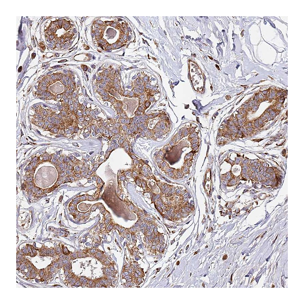 Atlas Antibodies Anti-ARFRP1 Antibody