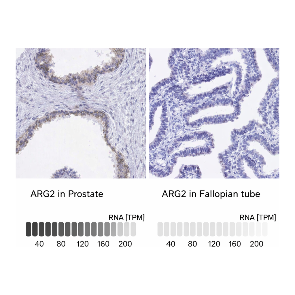 Atlas Antibodies Anti-ARG2 Antibody