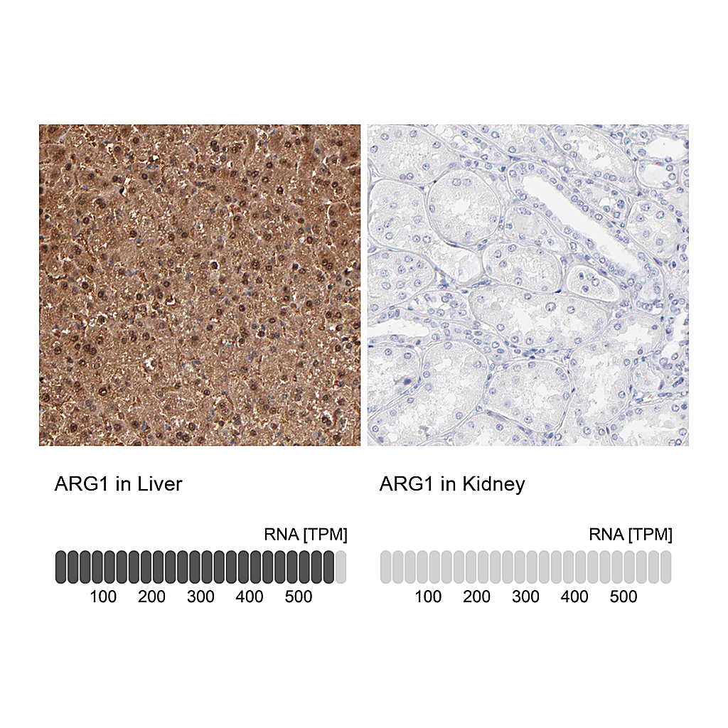 Atlas Antibodies Anti-ARG1 Antibody