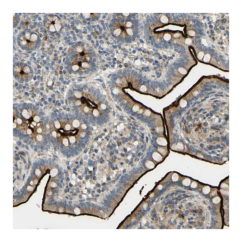 Atlas Antibodies Anti-ARHGAP1 Antibody