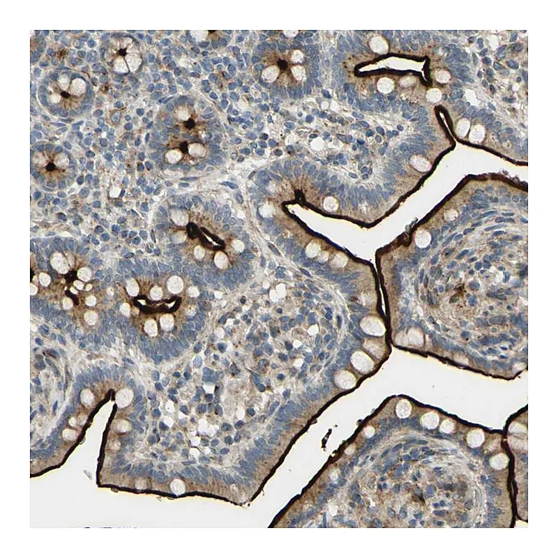 Atlas Antibodies Anti-ARHGAP1 Antibody